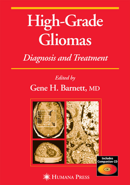 High-Grade Gliomas main product photo