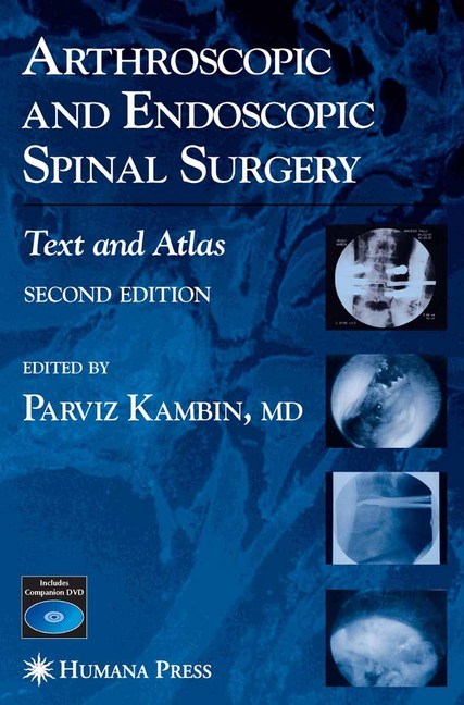Arthroscopic and Endoscopic Spinal Surgery main product photo