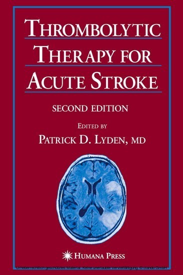 Thrombolytic Therapy for Acute Stroke main product photo