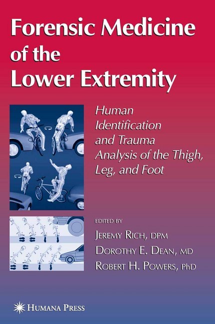 Forensic Medicine of the Lower Extremity main product photo