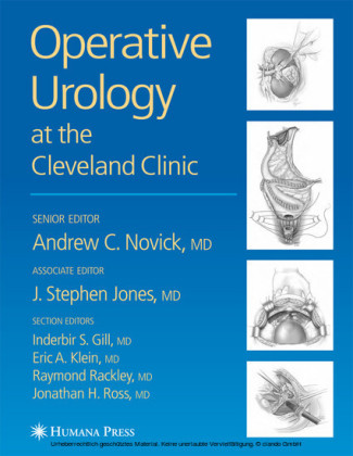 Operative Urology