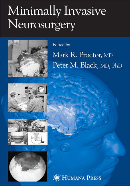 Minimally Invasive Neurosurgery main product photo