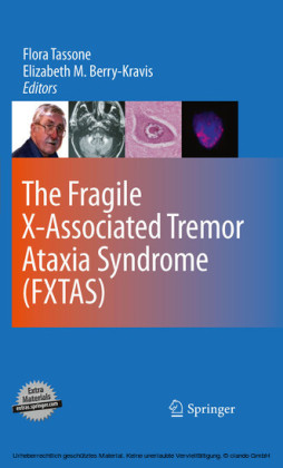 The Fragile X-Associated Tremor Ataxia Syndrome (FXTAS)