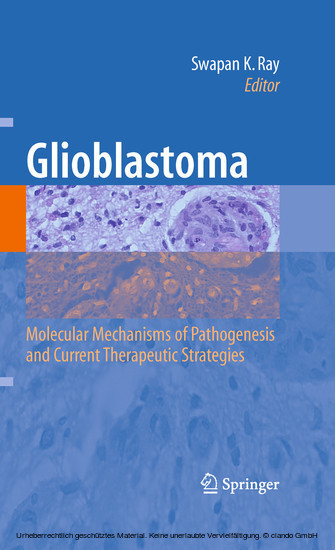 Glioblastoma: main product photo