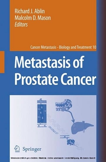 Metastasis of Prostate Cancer main product photo