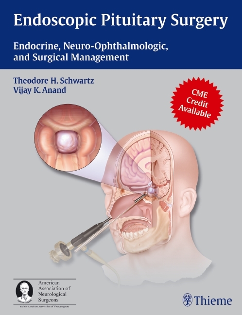 Endoscopic Pituitary Surgery main product photo
