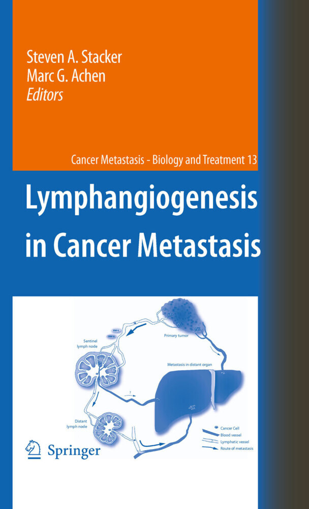 Lymphangiogenesis in Cancer Metastasis main product photo