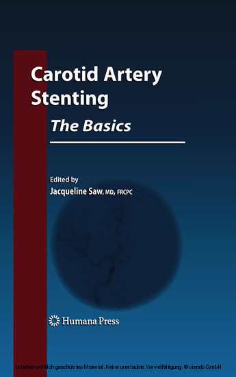 Carotid Artery Stenting: The Basics main product photo