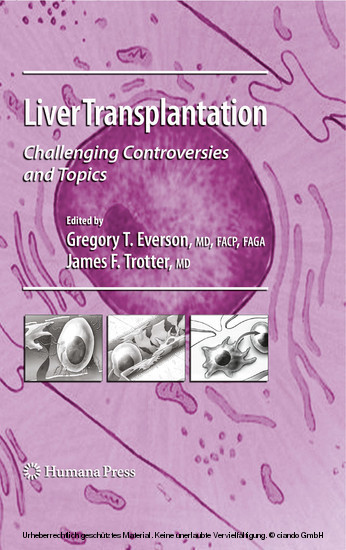 Liver Transplantation main product photo