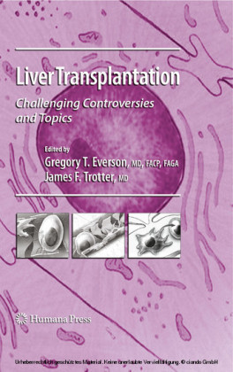 Liver Transplantation