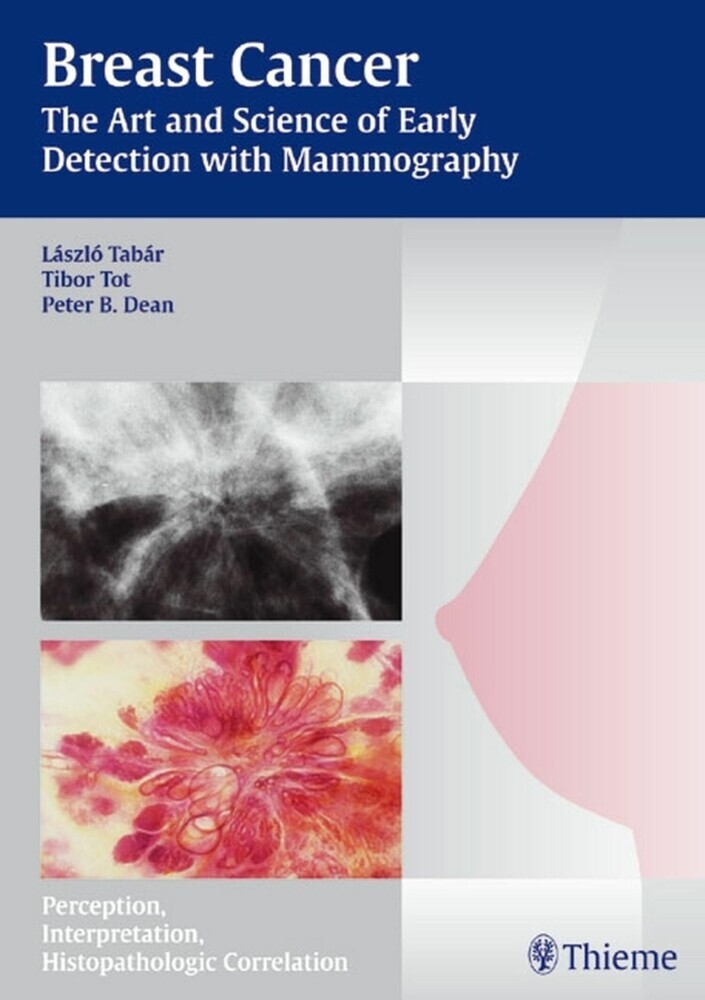 Breast Cancer - The Art and Science of Early Detection with Mammography main product photo