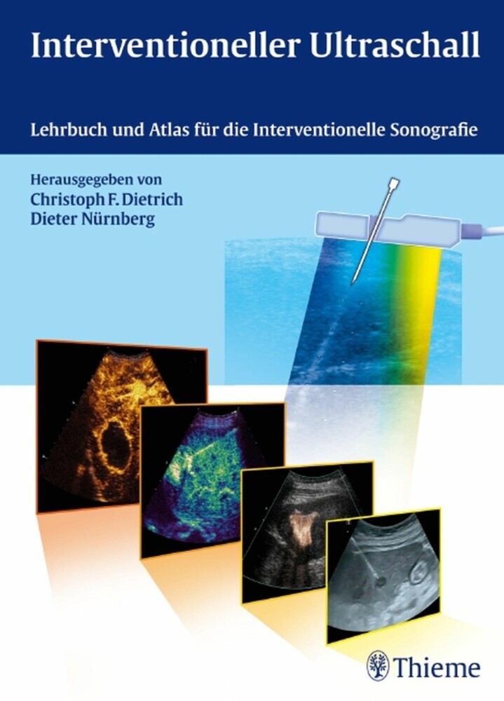 Interventioneller Ultraschall main product photo