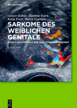 Glattmuskuläre und stromale Tumoren. Bd.1