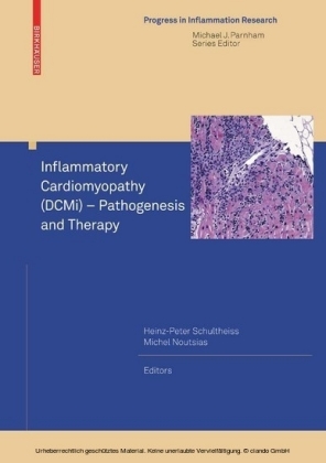 Inflammatory Cardiomyopathy (DCMi) - Pathogenesis and Therapy
