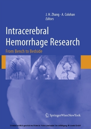 Intracerebral Hemorrhage Research