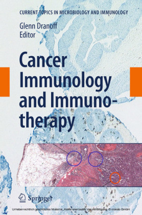 Cancer Immunology and Immunotherapy