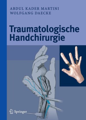 Traumatologische Handchirurgie