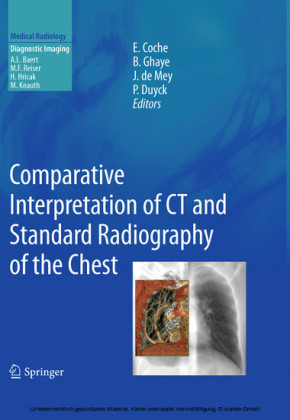 Comparative Interpretation of CT and Standard Radiography of the Chest