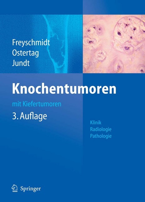 Knochentumoren mit Kiefertumoren main product photo