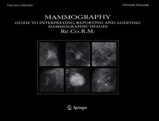 Mammography main product photo