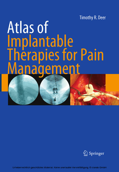 Atlas of Implantable Therapies for Pain Management main product photo