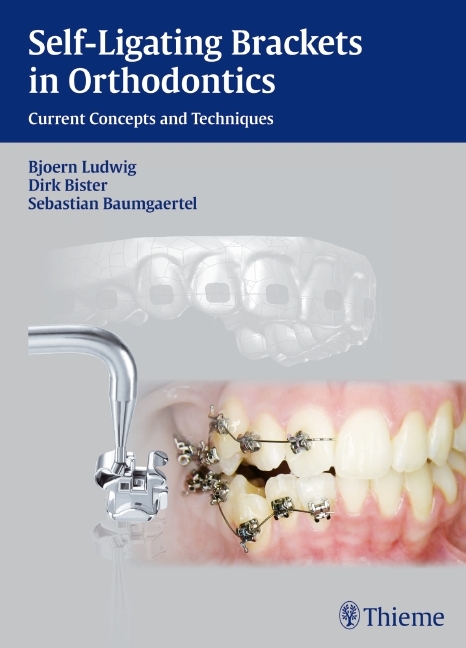 Self-ligating Brackets in Orthodontics main product photo