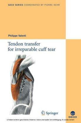 Tendon transfer for irreparable cuff tear