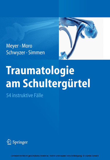 Traumatologie am Schultergürtel main product photo