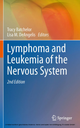 Lymphoma and Leukemia of the Nervous System