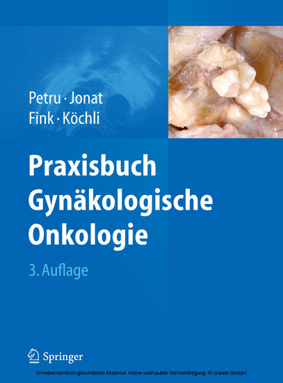 Praxisbuch Gynäkologische Onkologie main product photo