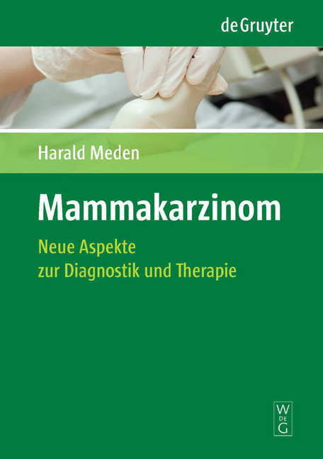 Mammakarzinom main product photo