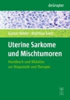 Uterine Sarkome und Mischtumoren main product photo