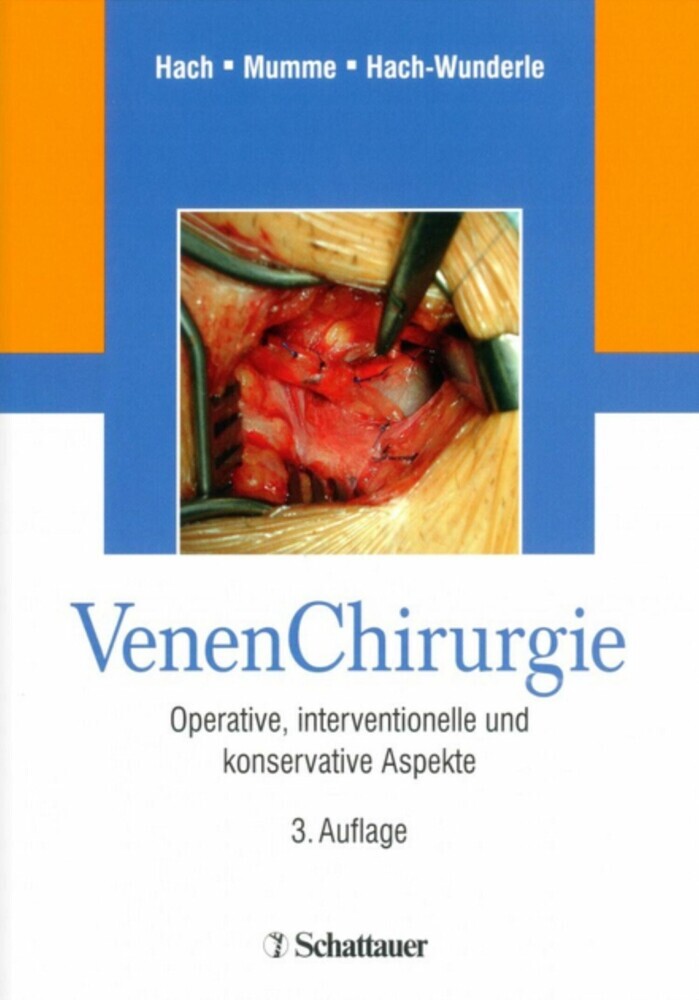 Venen Chirurgie main product photo