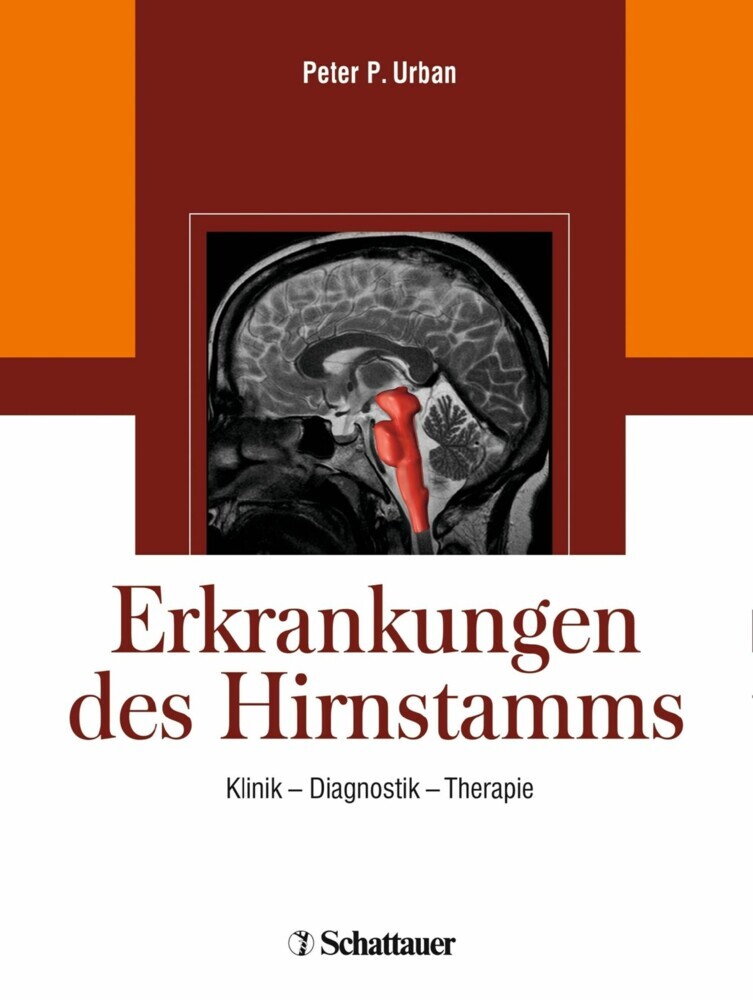 Erkrankungen des Hirnstamms main product photo
