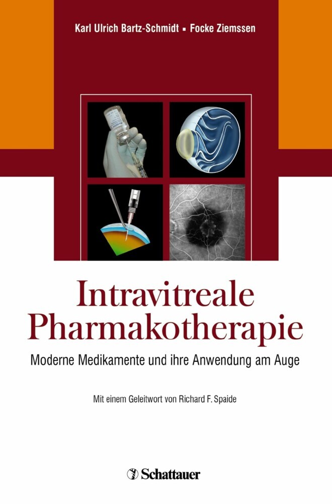 Intravitreale Pharmakotherapie main product photo