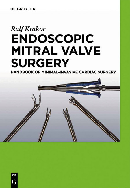 Endoscopic Mitral Valve Surgery main product photo