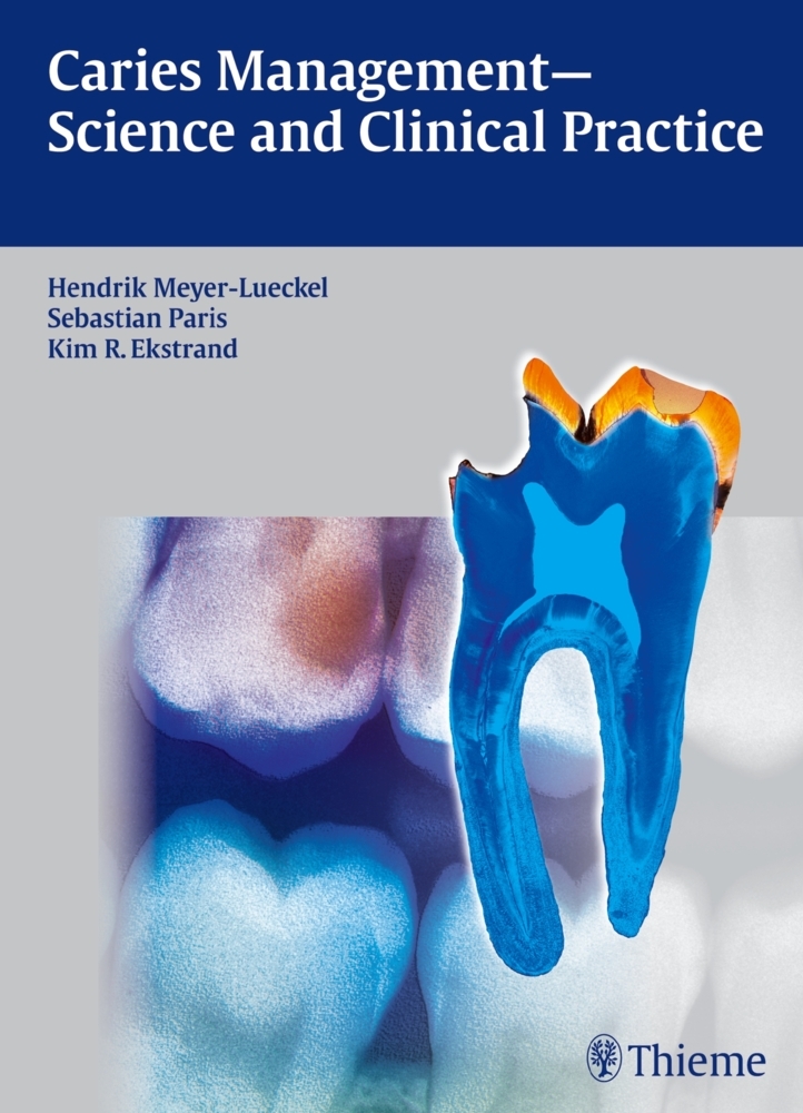 Caries Management - Science and Clinical Practice main product photo