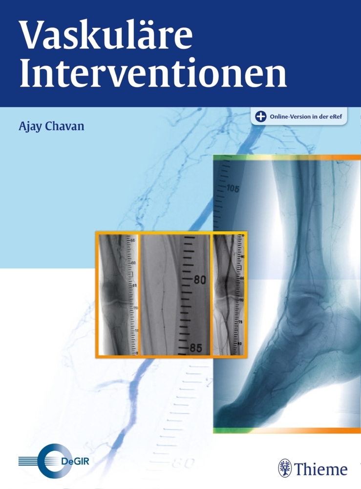 Vaskuläre Interventionen main product photo