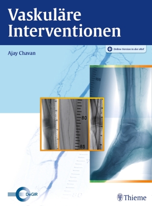Vaskuläre Interventionen