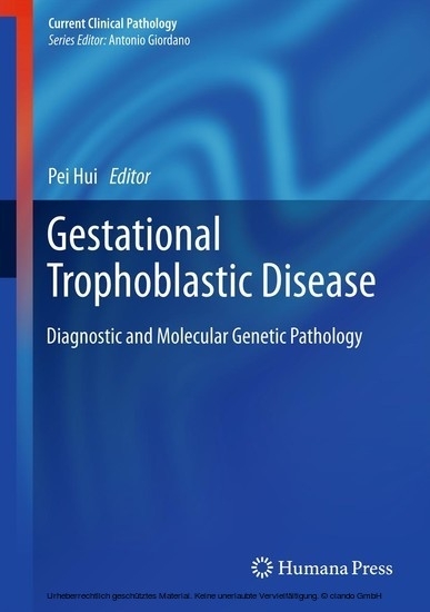 Gestational Trophoblastic Disease main product photo
