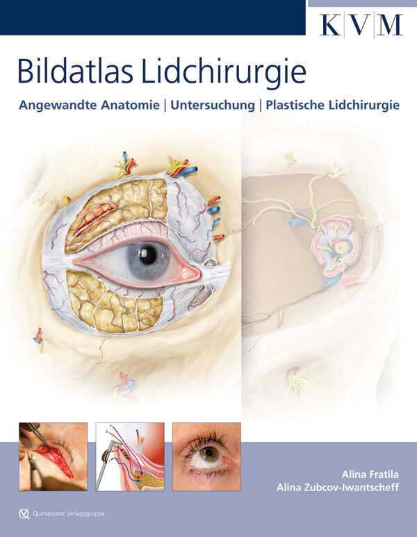 Bildatlas Lidchirurgie main product photo