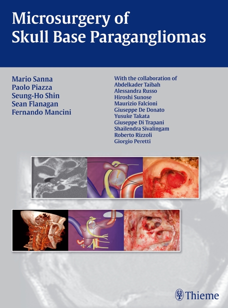 Microsurgery of Skull Base Paragangliomas main product photo