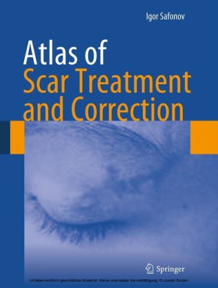 Atlas of Scar Treatment and Correction