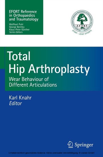 Total Hip Arthroplasty main product photo