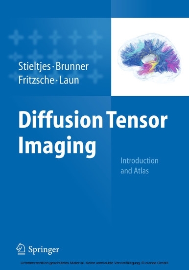 Diffusion Tensor Imaging main product photo