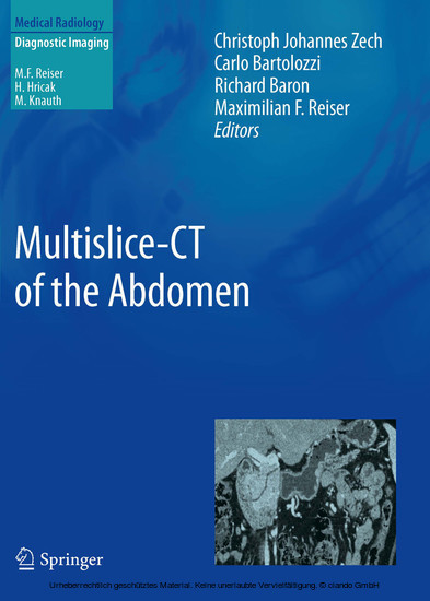 Multislice-CT of the Abdomen main product photo