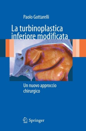 La turbinoplastica inferiore modificata