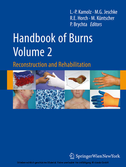 Handbook of Burns Volume 2 main product photo