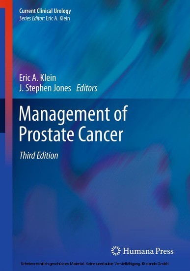 Management of Prostate Cancer main product photo
