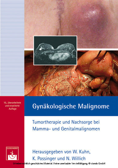 Gynäkologische Malignome main product photo